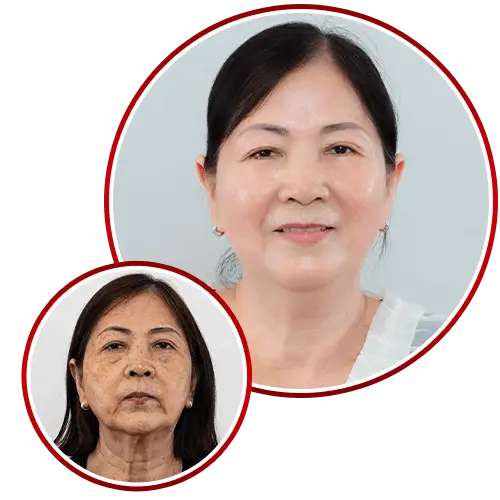 Phòng Khám Da Liễu Elizabeth Siri – Chuyên Điều Trị Nám Da